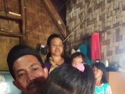 Dila Anak Usia 10 Tahun warga Pekon Taman Sari Kec Pugung Kab Tanggamus Rindu Uluran Tangan Pemerintah Tanggamus dan Para Dermawan