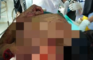 KEJAM..!! Dalam Keadaan Terbaring Sakitpun Tetap Di Hajar