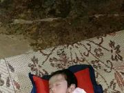 Bayi Mungil Laki – Laki 2,5 Tahun Alami Adanya Sumbatan Di Saluran Usus