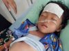 Akibat Biaya, Sevila Latifa Anggraeni (5) Tanggamus Butuh Uluran Tangan