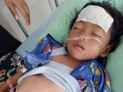 Akibat Biaya, Sevila Latifa Anggraeni (5) Tanggamus Butuh Uluran Tangan