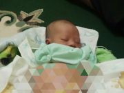 Pasca Operasi Bayi Rizky Ramadhan Warga Tanggamus Tidak Bisa Pulang Karena Biaya