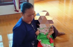Nafiza Balita Penderita Hidrosifalus Butuh Perhatian Pemkab Tubaba
