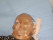 Karyawan PT. Crumb Rabber Mesuji Terlantar Di Rumah Sakit, Karena Belum Ada Yang Penanggung Jawab