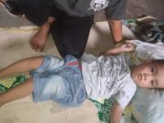 Muhammad abizrd al-zain Bocah Penderita Cerebral Palsy Spastic Butuh Perhatian dari Pemerintah TuBaBa Dan Dermawan