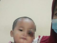 Balita Mengidap Kanker Mata, Butuh Uluran Tangan Dermawan